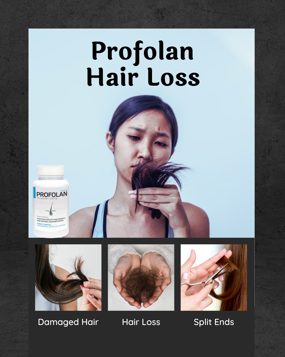 Profolan: The Ultimate Solution for Hair Loss post thumbnail image
